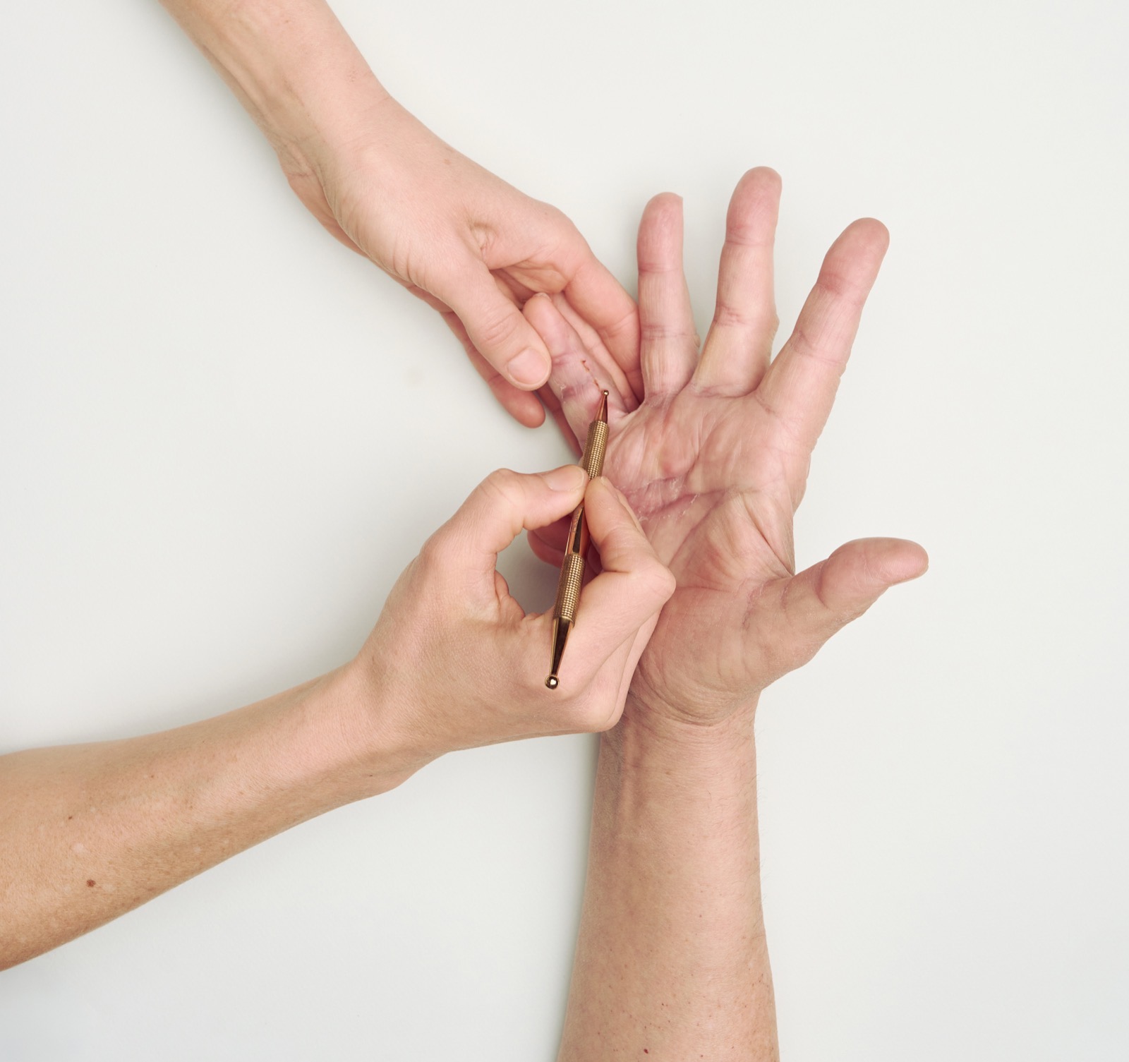 Handtherapie in Graz – Behandlung